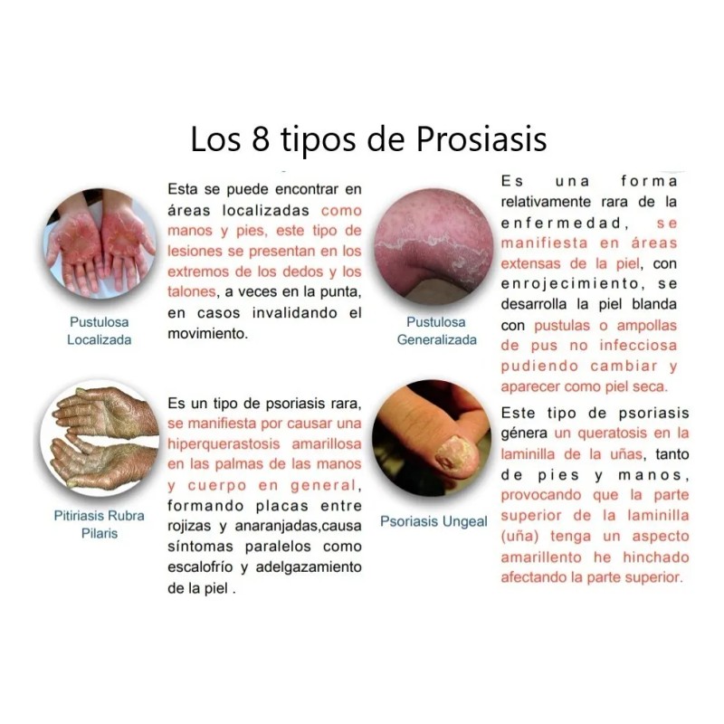 500gr Crema Mas Suave, Pomada Nopsor 125gr Aux. Tx Psoriasis