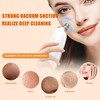IGEAIIE Blackhead Remover Vacuum, Pore Vacuum with 5 Replaceable Suction