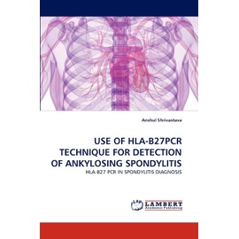 USE OF HLA-B27PCR TECHNIQUE FOR DETECTION OF ANKYLOSING SPONDYLITIS: HLA-B27 PCR IN SPONDYLITIS DIAGNOSIS