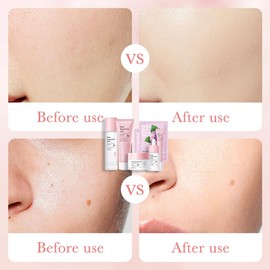 Skin Care Sets & Kits,Skincare Set for Women & Teenage Girls with Rose Extracts-Face Cream,Essence,Toner,Cleanser,Eye Cream,Mask,Pamper Gifts For Women,Gift Sets for Women,Skin Care for Teenage Girls