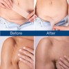 Admirada Silicone Sheets for Scars: Reusable Scar Care Tape for