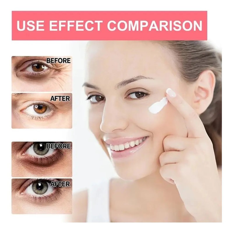 Crema De Ojos Con Retinol Antiedad Hidratante Antiarrugas