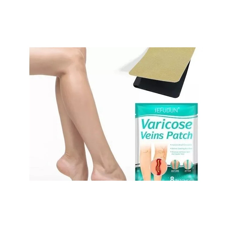 Parche para Aliviar el Dolor de Venas Varicosas y Varices