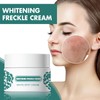 Whitening Freckle Cream, Face Cream Against Dark Spots, Anti Pigment