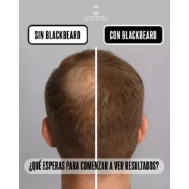 Shampo Anticaída Blackbeard Con Cafeína Y Aceites Esenciales