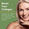 General Healthcare Hydrolysed Bovine Collagen Peptides Powder, 300g