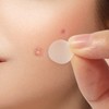 SUMLIVING Acne Patches,180 Pieces Spot Patches for Face,Invisible Patches Stickers,Pimple