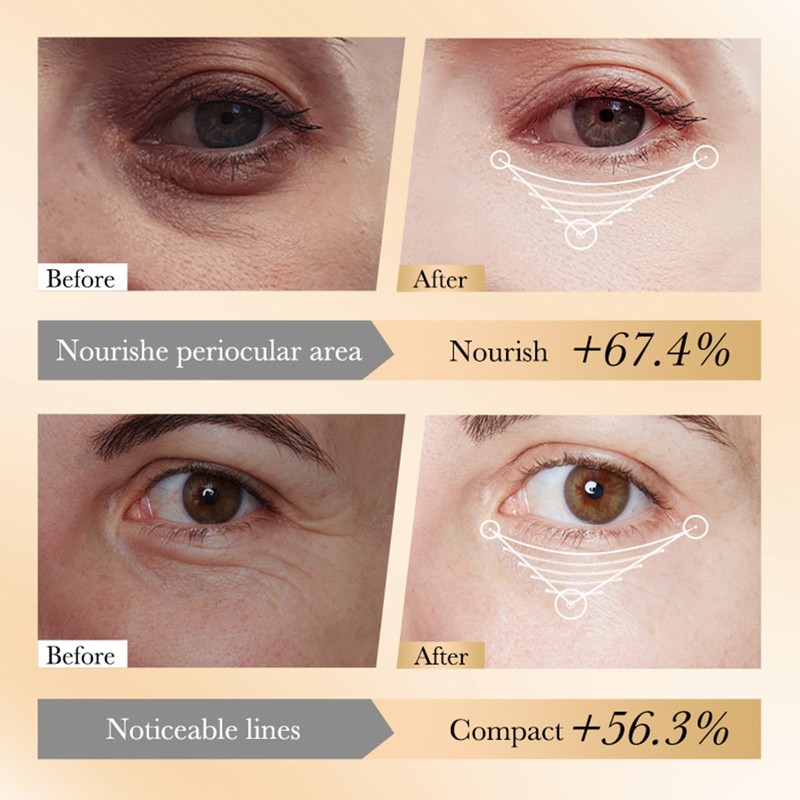 Kollagen -Hautpflege -Serie (1pcs, Anti-wrinkle eye cream)