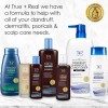 True+real Shampoo Terapéutico T Plus / T Gel 473 Ml