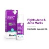 The Derma Co. Sali Cinamide Anti Acne Serum with 2%