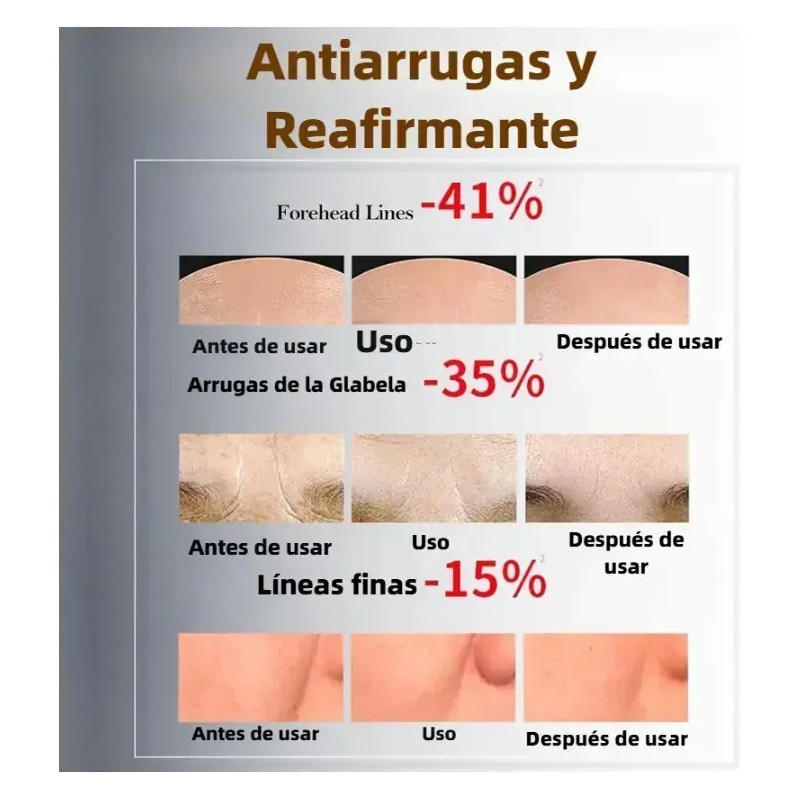 Cyrene Parches Estrella Star Anti Acne Espinillas Granos Fac