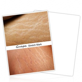 Pre-Printed Stretch Mark Tattoo Practice Skin – 1mm Silicone Camouflage Training Pad – Realistic Fake Skin for Tattoo Beginners & Artists (5PCS Pad)