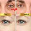 Parches Hydrogel Contorno Ojos 24k Antiarrugas Hidrata 60 Pz