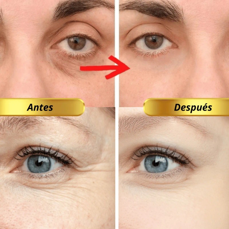 Parches Hydrogel Contorno Ojos 24k Antiarrugas Hidrata 60 Pz