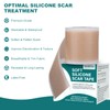 Silicone Scar Sheets (1.6"x 158" Roll-4M), Silicone Scar Tape for
