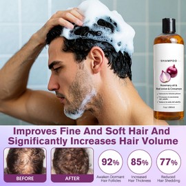 Shampoo De Cebolla, Shampoo Para Hombre with Rosemary Oil & Red Onion & Cinnamon Extract, Strengthen Hair Roots, Reduce Hair Loss, Promote Hair Growth For Women Men, 7oz/200ml (1)