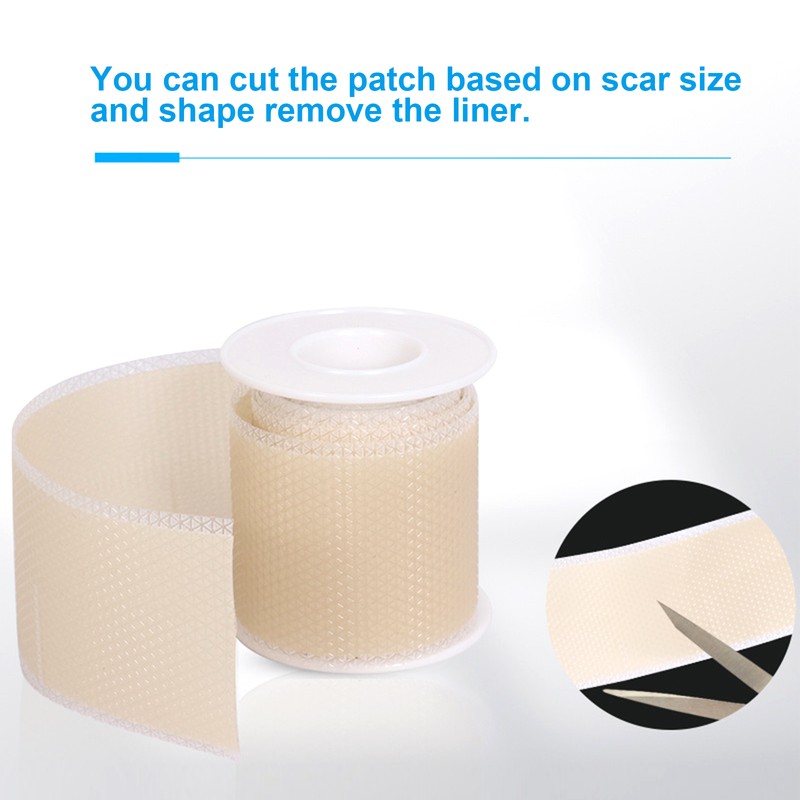 Adhesive Silicone Scar Patch Safety Mild Fade Scar Scar Reduction