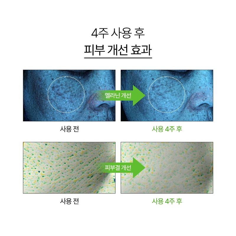Nature Republic Whitening Nature Republic Vita Fair C Blemish Serum