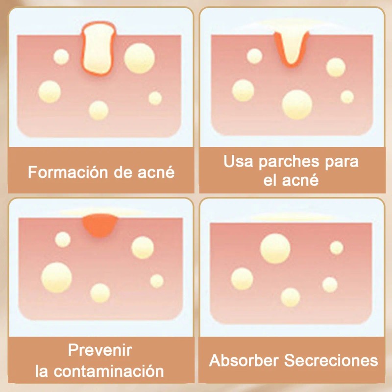 🔥 240pzs mascarillas estrella para el acne espinillas granos Vitaminas