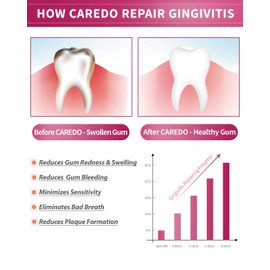 CAREDO Gingivitis Toothpaste Gum Repair for Bleeding Gums, Swollen Gums Treatment for Gum Sensitivity, Gingivitis Treatment for Gum Disease, Reverse Gingivitis Treatment for Adults Oral Care, 3.52OZ