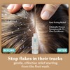 DHS Zinc Shampoo – Dandruff Shampoo – for Flaky and