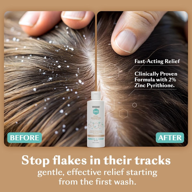 DHS Zinc Shampoo – Dandruff Shampoo – for Flaky and