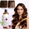 2pzs Shampoo Lexenic Excalvo Con Cebolla Y Aceite De Romer