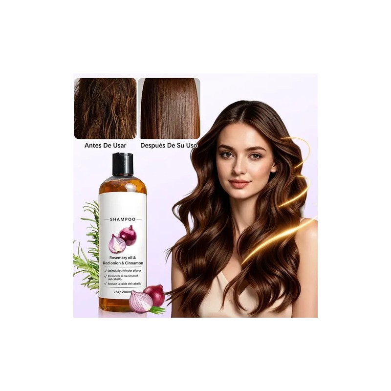 2pzs Shampoo Lexenic Excalvo Con Cebolla Y Aceite De Romer
