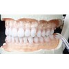 Dentrix SonicPulse ControlShot Oral Irrigator