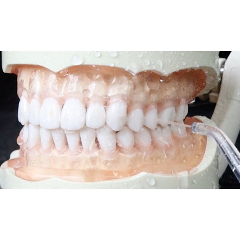 Dentrix SonicPulse ControlShot Oral Irrigator