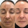 Crema Facial Manchas/arrugas Baba De Caracol Shelo Nabel
