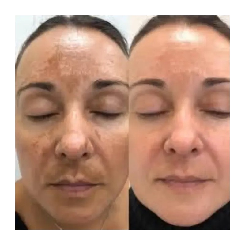 Crema Facial Manchas/arrugas Baba De Caracol Shelo Nabel