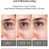 INIA LUMIN Under-Eye Red Light Therapy for Face, 4-in-1 Beauty
