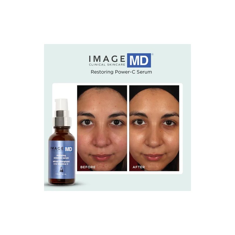 Suero De Vitamina C Restaurador Image Skincare 30 Ml 1