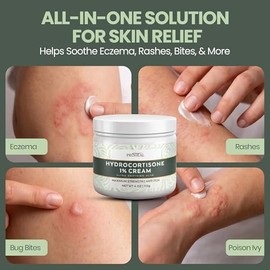 ProHeal Crema de hidrocortisona al 1% de máxima fuerza con aloe, 4 onzas de crema antipicazón para picaduras de insectos, eczema, hiedra venenosa, rob