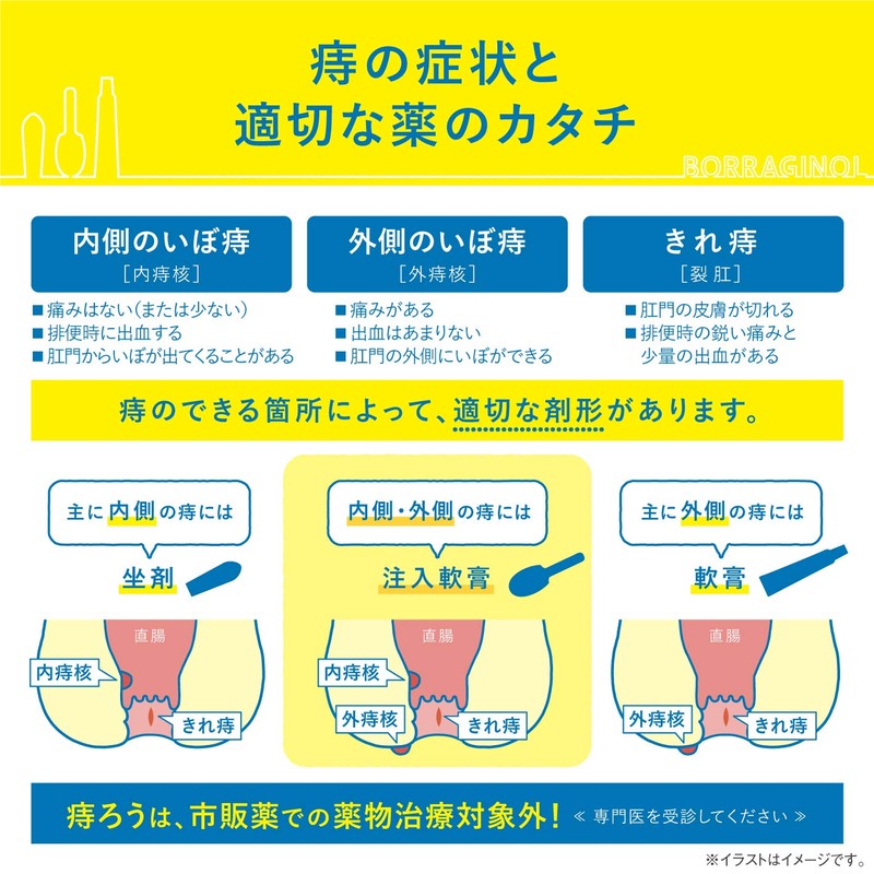 【指定第2類医薬品】ボラギノールA注入軟膏 2g×30個入
