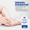60% Urea Cream，Urea Foot Cream，Foot Cream for Cracked Heels and