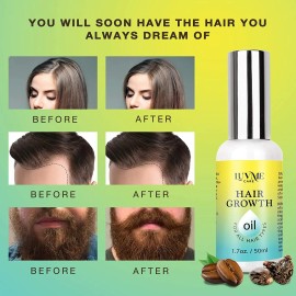 Luv Me Care Biotin Hair Growth Oil Hair Growth Serum, Thicker Longer EXP 06/2025