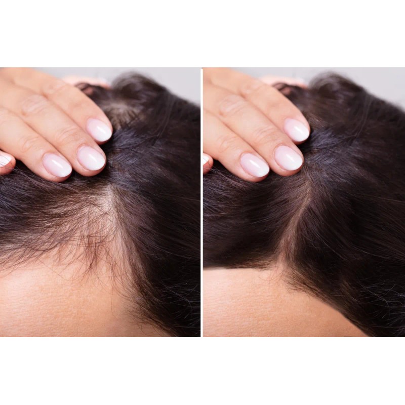 Fórmula Para El Crecimiento Del Cabello Velona 120 Ml Con