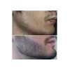Crecer La Barba Bigote Cejas Profesional Y Natural Novocrin