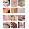 Ultrasonic Freckle Spots Removal Machine Detoxifying Face Care Machine for