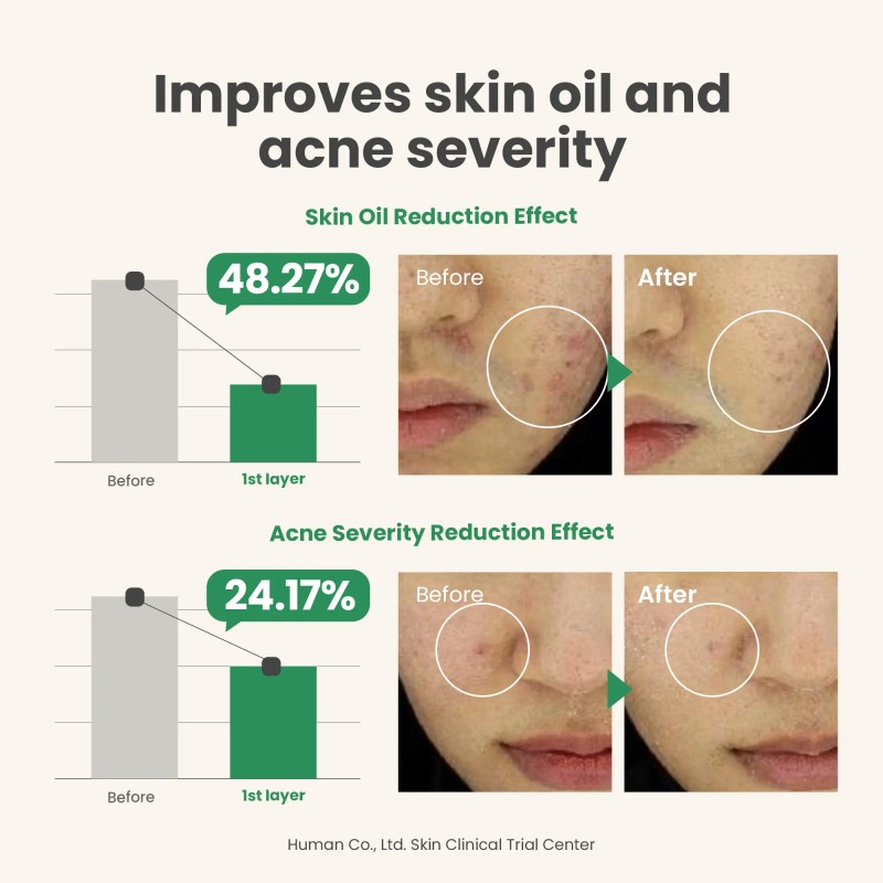 AXIS-Y [AXIS-Y]Spot the Difference Blemish Treatment 15ml