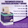 Parche De Cicatriz Silicona, Para Desvanece Cicatrices 2pcs