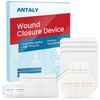 Emergency Wound Closure Strips-Repair Wounds Without Stitches&Hold Small Wound, Butterfly