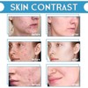 Boxiatil Aqua Peeling Solution AS1 - Care Aqua Facial Solutions