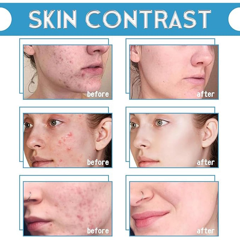 Boxiatil Aqua Peeling Solution AS1 - Care Aqua Facial Solutions