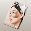 Marcique Freckle Cream Patch - Blemishes, Pigmentation, Dark Spots, Whitening,