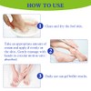 Urea Foot Cream, Urea Cream, Callus Foot Remover Gel, 100