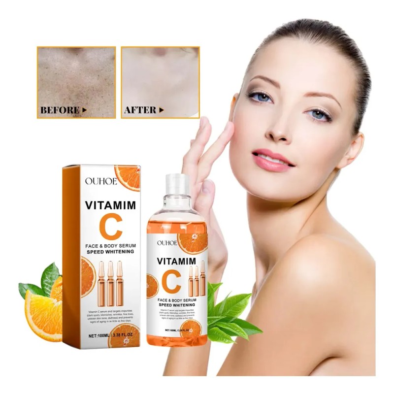 Sérum Facial Y Corporal Ouhoe Mejorado Con Vitamina C Fp