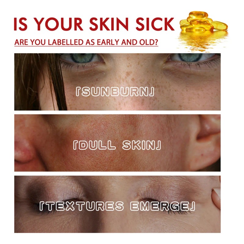 Crema Para Eliminar Manchas Oscuras Y Manchas Para Melasma Y
